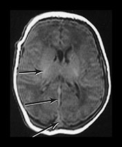 Fig. 9.15 (ai)