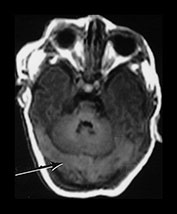 Fig. 9.15 (aii)