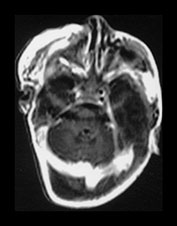 Fig. 9.15 (aiii)