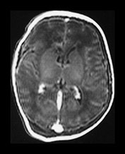 Fig. 9.15 (aiv)