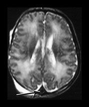 Fig. 9.15 (b)