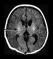 Fig. 9.15 (ci)