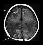 Fig. 9.15 (cii)