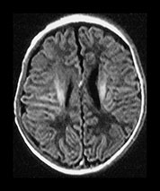 Fig. 9.16 (bi)