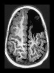 Fig. 9.17 (bi)