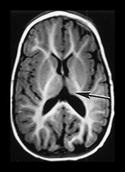 Fig. 9.17 (bii)