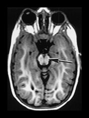Fig. 9.17 (biii)