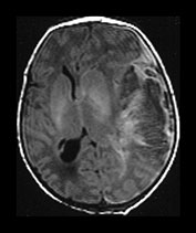 Fig. 9.18 (ai)