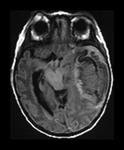 Fig. 9.18 (aii)