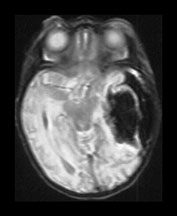 Fig. 9.18 (aiii)