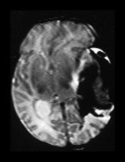 Fig. 9.18 (aiv)
