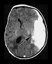 Fig. 9.18 (bi)