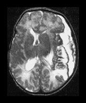 Fig. 9.18 (bii)