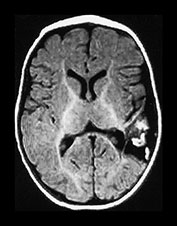 Fig. 9.18 (ci)