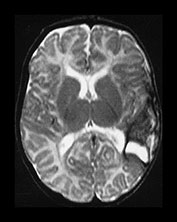 Fig. 9.18 (cii)