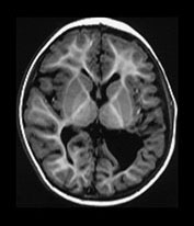Fig. 9.19 (bi)
