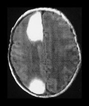 Fig. 9.20 (ai)