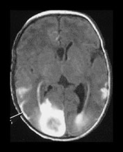 Fig. 9.20 (aii)