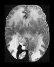 Fig. 9.20 (aiv)