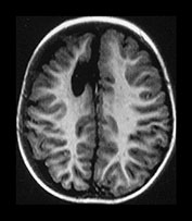 Fig. 9.20 (bi)