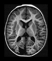 Fig. 9.20 (bii)