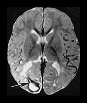 Fig. 9.20 (biii)