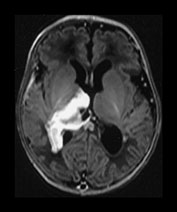 Fig. 9.21 (a)