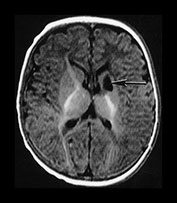 Fig. 9.22 (b)