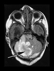 Fig. 9.23 (ai)