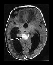 Fig. 9.23 (aii)