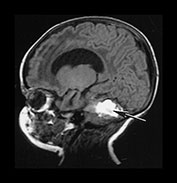 Fig. 9.23 (bi)