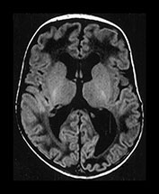 Fig. 9.23 (bii)