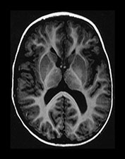 Fig. 9.23 (ci)