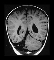 Fig. 9.23 (cii)
