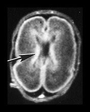 Fig. 9.24 (ai)