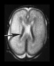 Fig. 9.24 (aii)