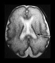 Fig. 9.24 (bi)