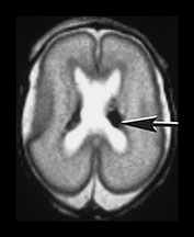 Fig. 9.24 (cii)