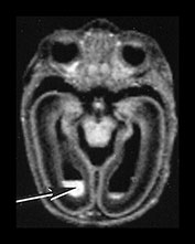 Fig. 9.24 (ciii)