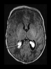 Fig. 9.25 (a)