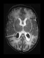 Fig. 9.25 (b)