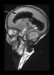 Fig. 9.26 (ai)