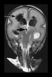 Fig. 9.26 (aii)