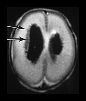 Fig. 9.26 (aiii)