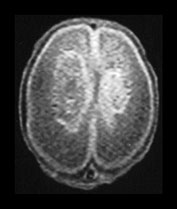 Fig. 9.26 (b)