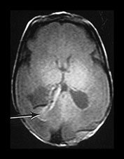 Fig. 9.27 (a)