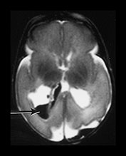 Fig. 9.27 (b)
