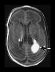 Fig. 9.28 (ai)