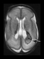 Fig. 9.28 (aii)
