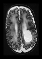 Fig. 9.28 (bi)